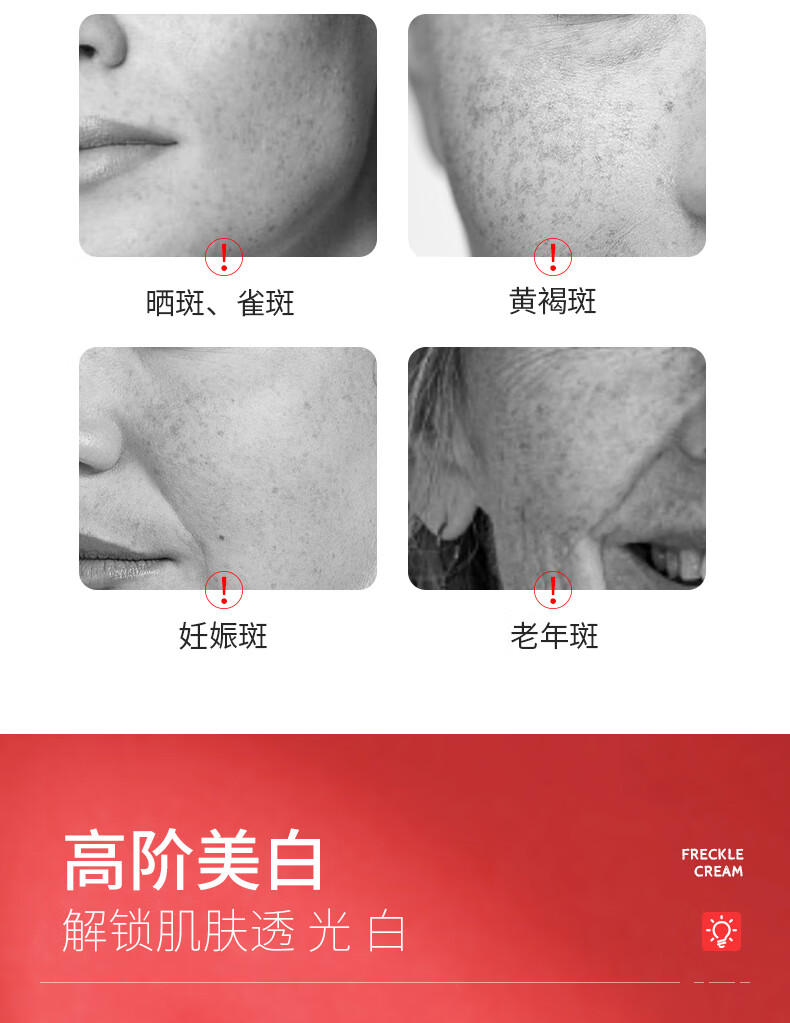 泊蝶（BEOTUA）肤研美白祛斑霜烟酰胺淡斑霜淡化黑色素皮研所南京祛斑霜20g*4