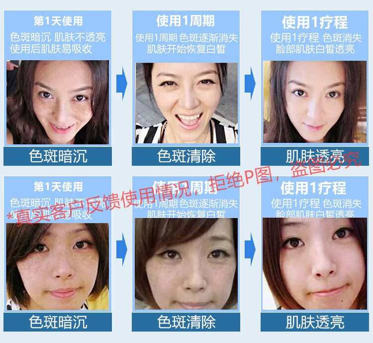 NHFOUYOU祛斑精华油点黑点玫瑰净颜精油补水美白提亮肤色溶斑精华美白淡斑 1瓶【体验装】