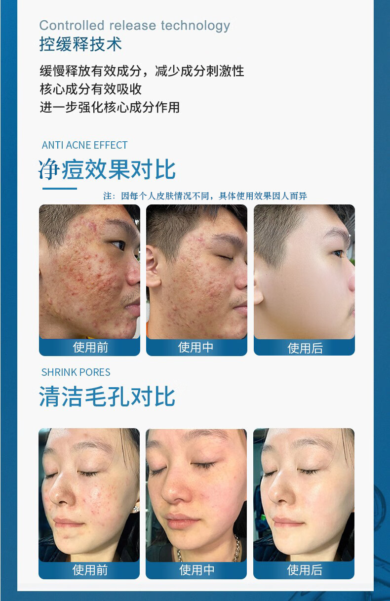同仁堂氨基酸洗面奶水杨酸抗痘净螨收缩毛孔黑头烟酰胺深层清洁面乳200g