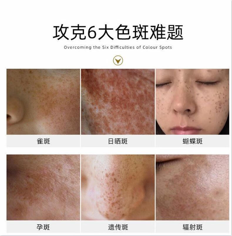 云南本草美白祛斑霜淡化雀斑黄褐斑妊娠斑晒斑老年斑男女通用20g