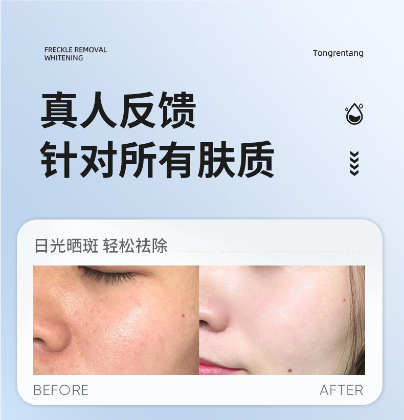 同仁堂祛斑霜美白淡化黑色素去斑淡斑雀斑黄褐斑晒斑男女士通用50g