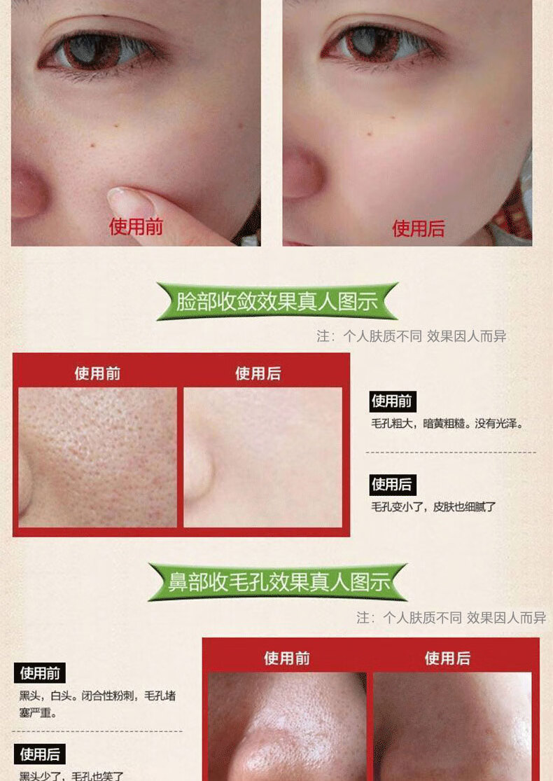 广药白云山爽肤水清爽控油收缩毛孔细致毛孔补水保湿男女通用300ml