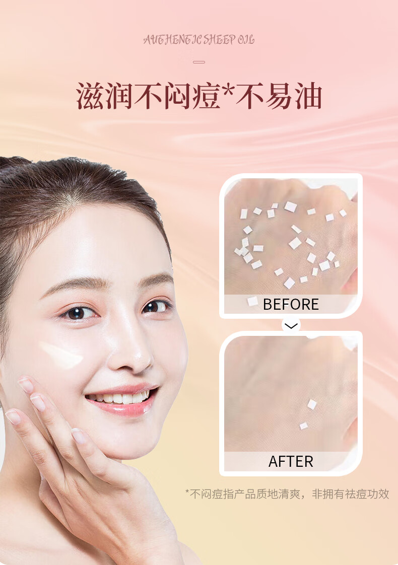 诺珊娜（larosanna） 澳洲进口绵羊油面霜 绵羊脂滋润维E霜润肤霜 补水保湿清爽润养 2盒*100g
