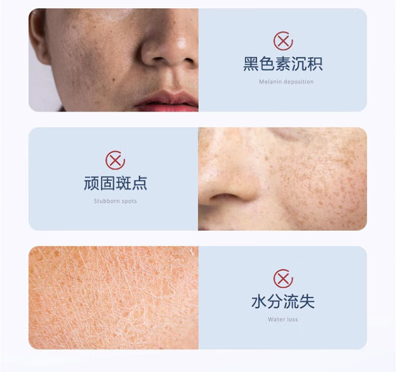HJZZ377美白面霜精华淡斑淡化斑点男女士提亮肤色补水保湿滋润50g