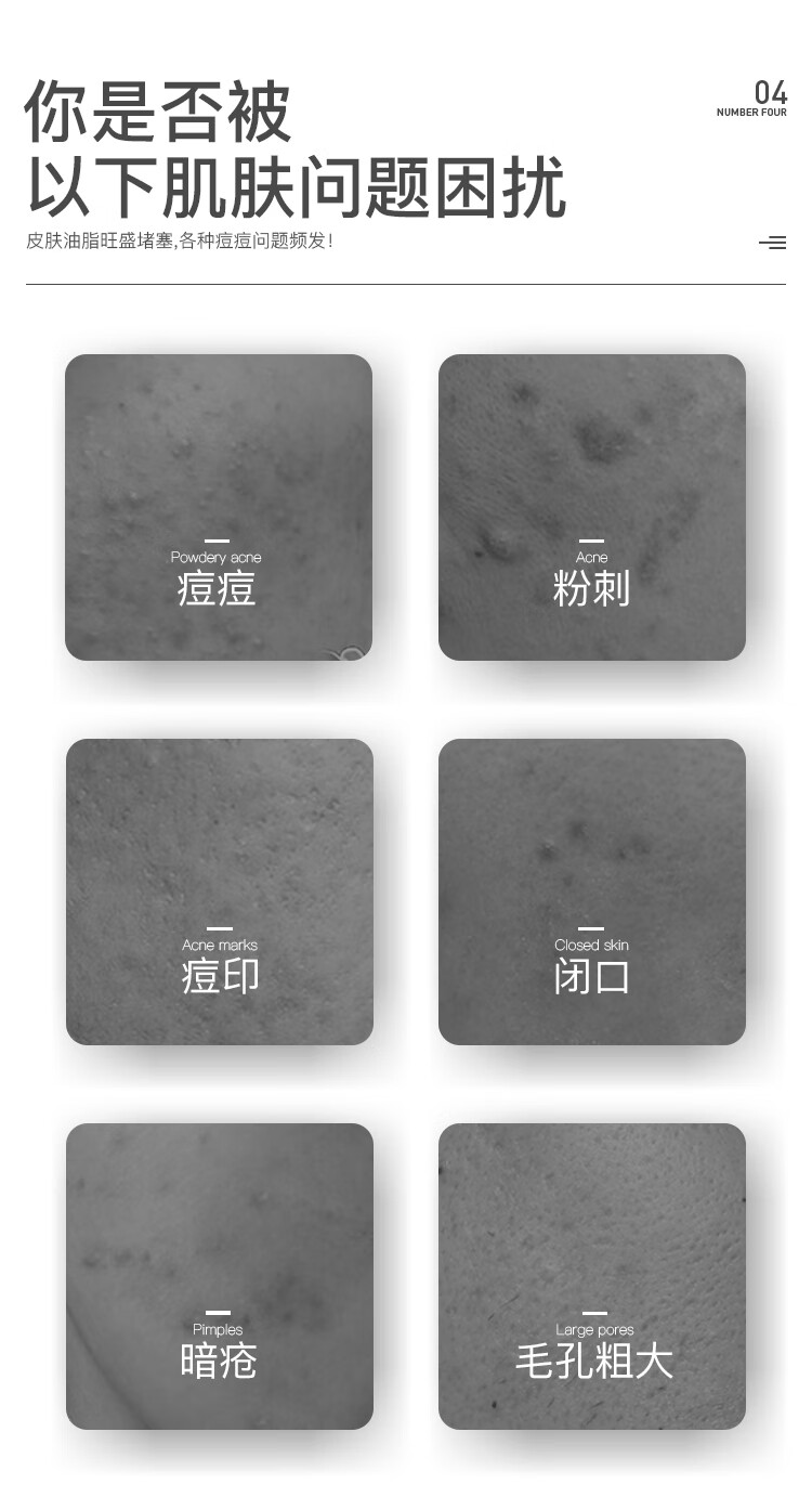 冰王芦荟胶清痘膏淡化痘印修护凝胶青春痘坑粉刺闭口男女士 20g