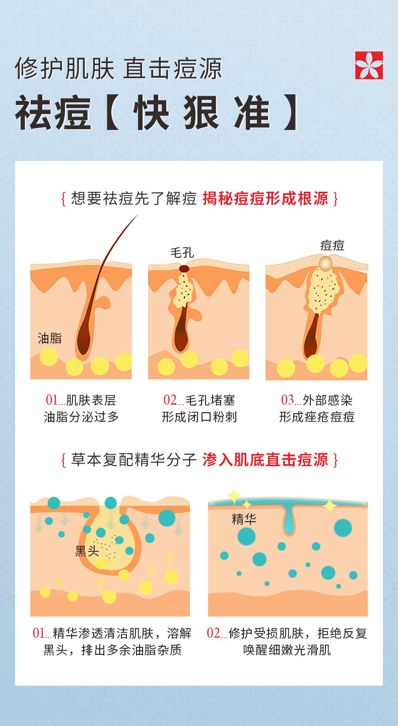 娅芝清肌净颜祛痘膏30g淡化痘印痘坑祛痘贴修护复凹洞闭口粉刺水杨酸壬二酸去痘痘凝胶精华男女士青春痘学生
