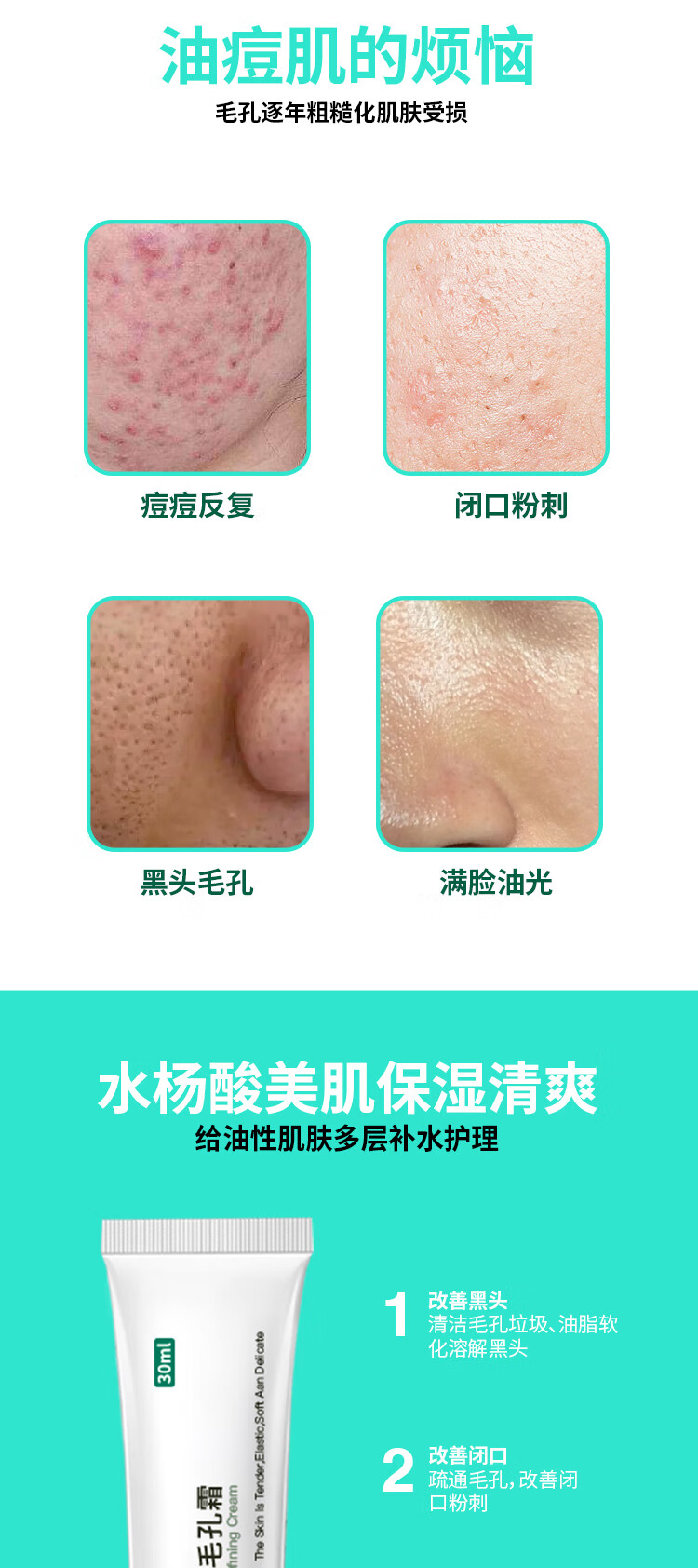 STVKG壬二酸15%凝胶水杨酸细致毛孔霜去痘黑头粉刺早晚祛痘膏30ml