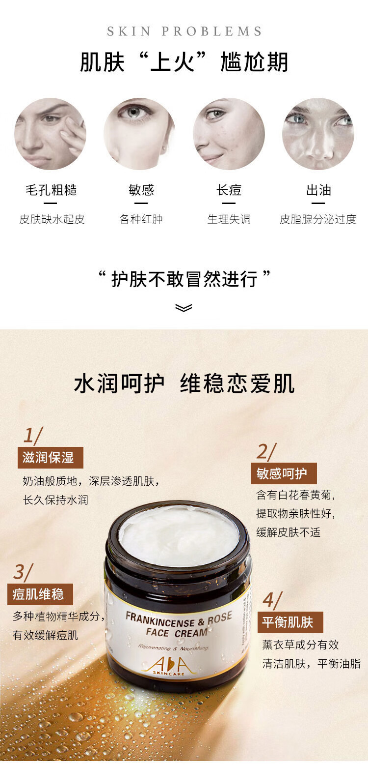 AA网（AA SKINCARE）蔷薇滋养面霜60ml（补水保湿 水油平衡 舒缓维稳 调理痘肌）