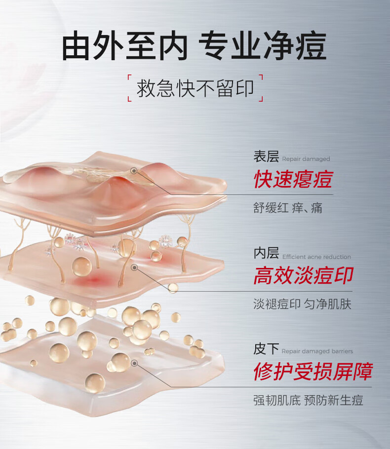 ning新加坡进口祛痘凝露淡化痘印修护痘痘红肿痘疤痘坑收缩毛孔芦荟胶