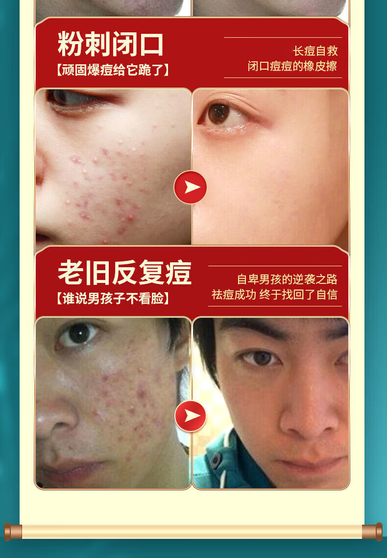 同仁堂草本祛痘膏痘印淡化清痘印痘坑修复和青春痘闭口粉刺男女士20g