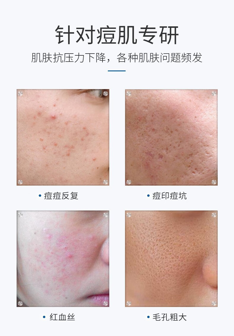 修正 烟酰胺寡肽冻干粉 精华液痘印痘坑凹洞收缩毛孔去角质层安瓶寡液肽原液精华 一盒3对装