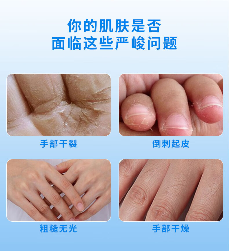 sakose凡士林牛奶蜂蜜手足蜡120ml*2瓶 去角质死皮淡化细纹补水撕拉手膜