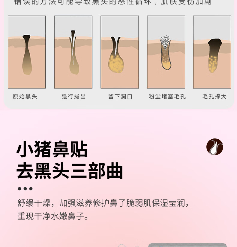 玛贝拉mayllie去黑头鼻贴5p(撕拉式鼻贴膜套装T区护理收缩毛孔男女可用)