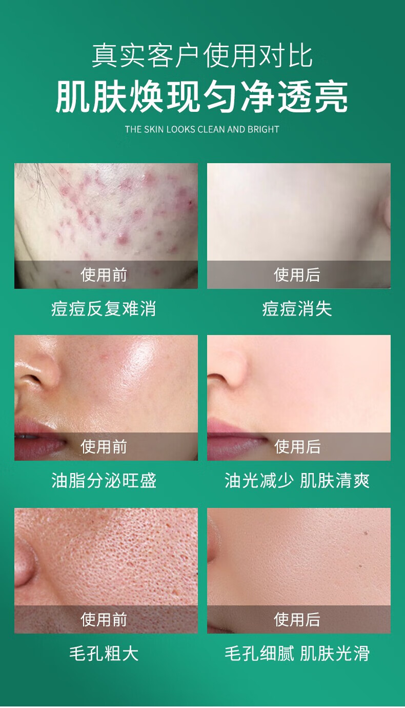 BAINHR积雪草洗面奶控油深层清洁毛孔抗痘氨基酸温和保湿洁面乳300ml