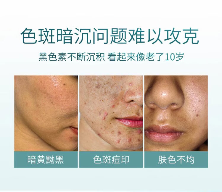 素秀臣氏广药白云山烟酰胺原液10%美白淡斑祛斑次抛精华液15ml