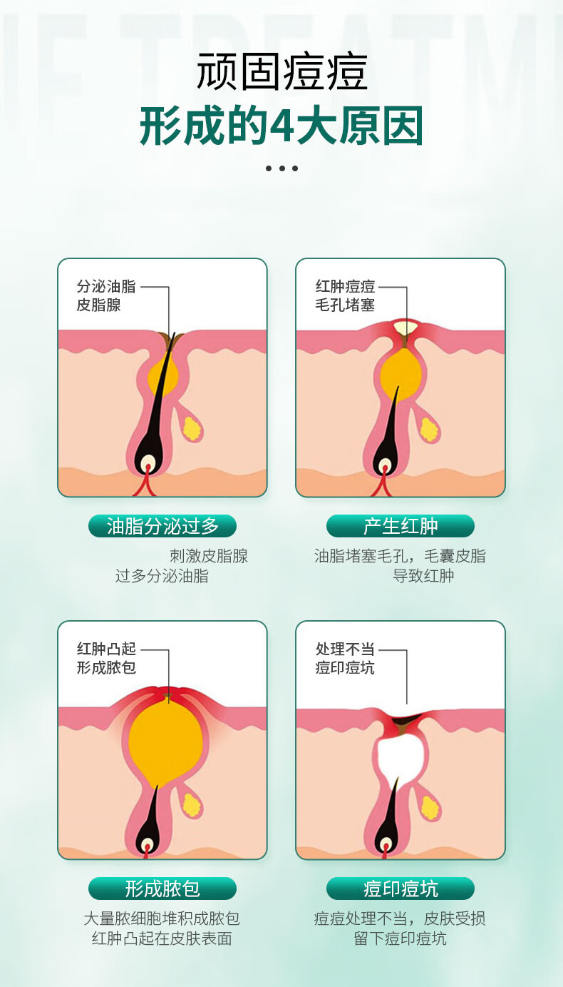 南京同仁堂 祛痘膏淡化痘印男女士青春痘闭口粉刺痘坑呵护痘肌去痘30g