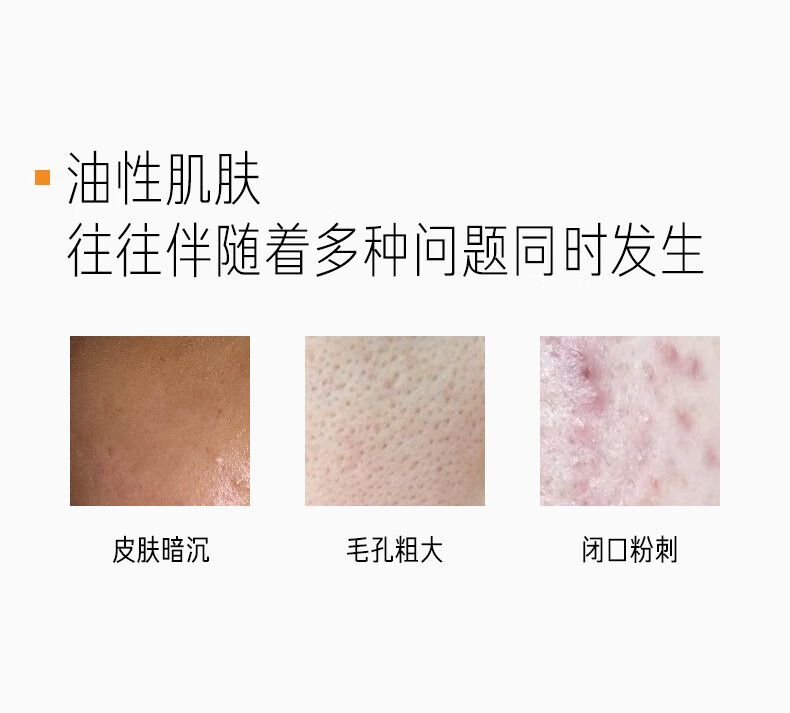 毕生之研指橙柔酸精华水 缩毛孔补水控油去黑头闭口男士护肤爽肤水收缩水 柔酸指橙精华水100ml