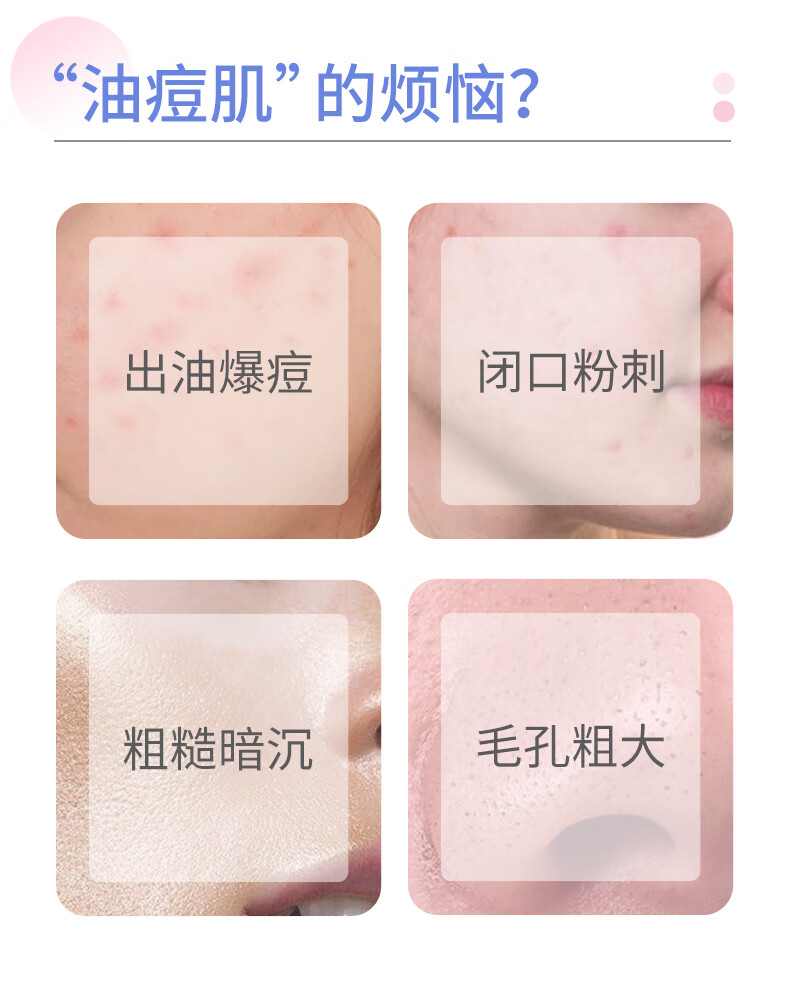 芙清密钥水杨酸洗面奶祛痘温和洁面乳女深层清洁毛孔控油去角质男  100g