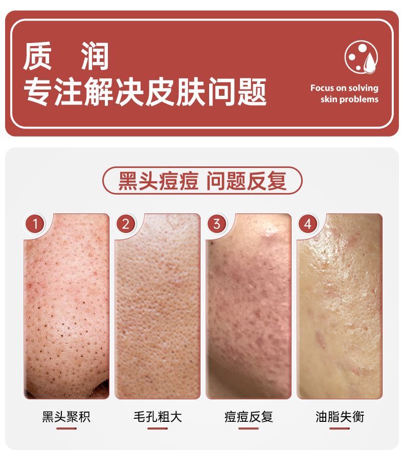 质润复合壬二酸15%凝胶15g水杨酸祛痘膏去黑头闭口粉刺15%任二酸凝胶