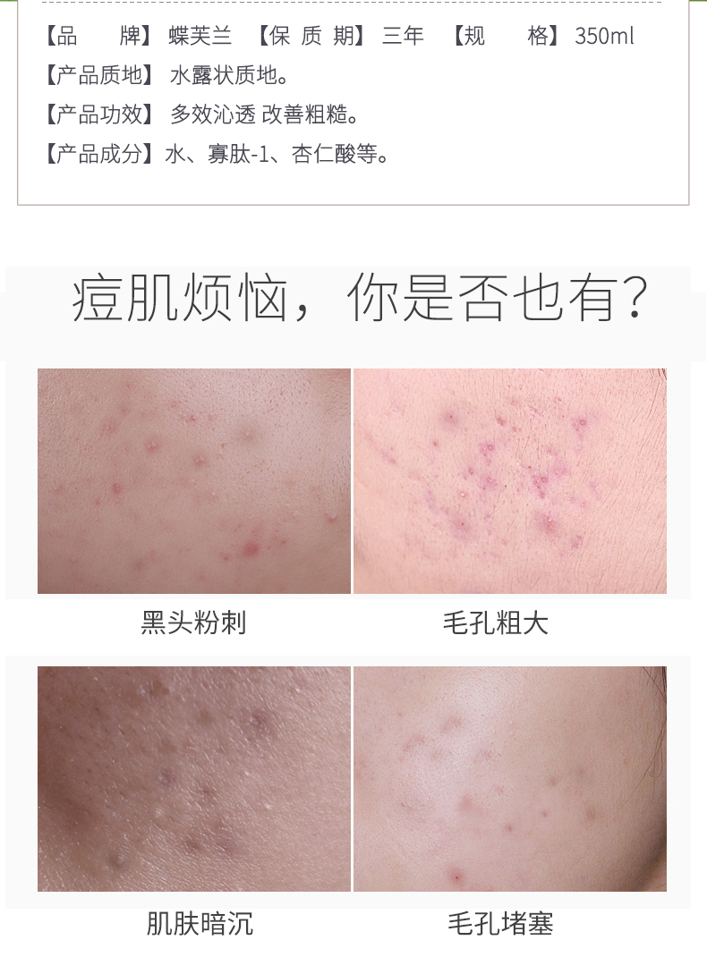 蝶芙兰寡肽痘肌修护爽肤水精华水保湿水控油淡化痘印350ml男女士通用