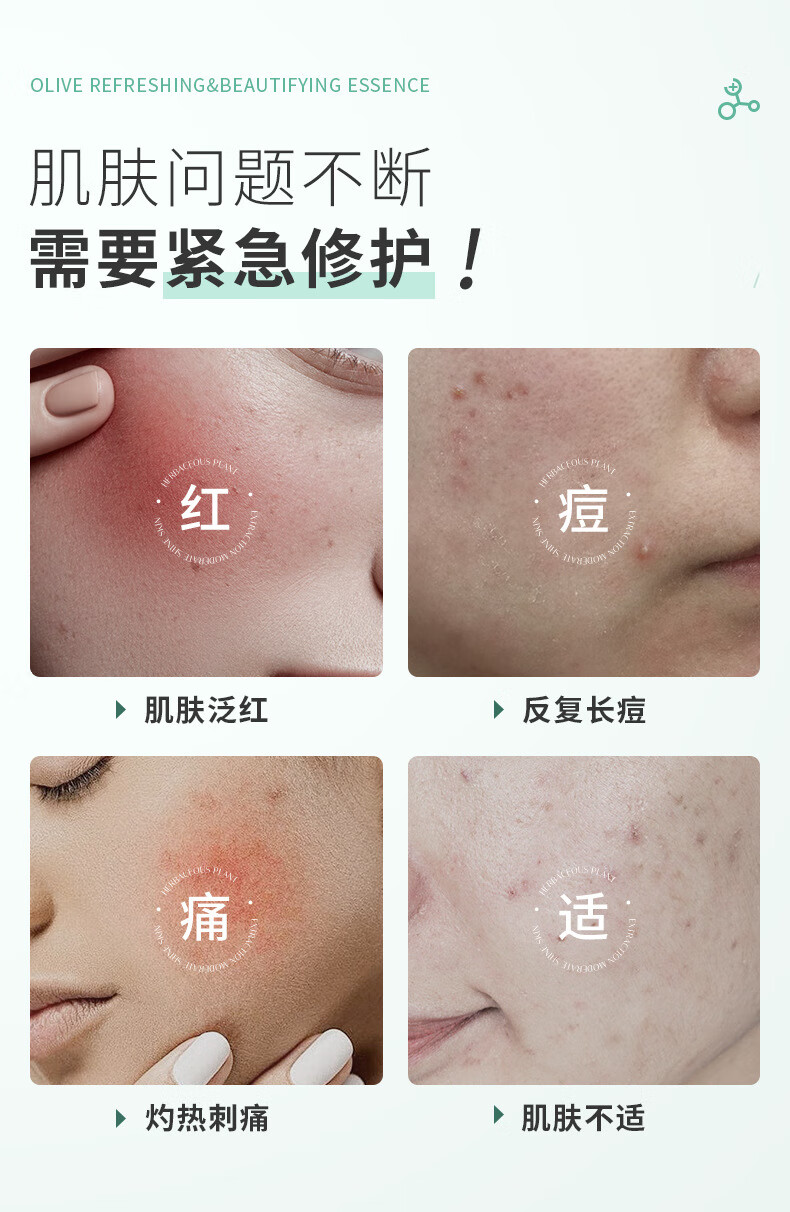仕月油橄榄精华液熊果苷提亮肤色面部舒缓净痘淡红补水保湿30ml