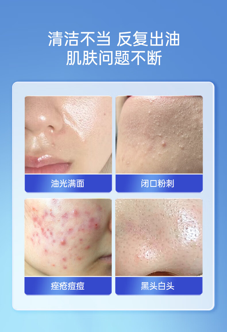 绿漾（Greentouch）水杨酸洗面奶祛痘抗痘深层清洁控油保湿去黑头去角质男士洁面乳