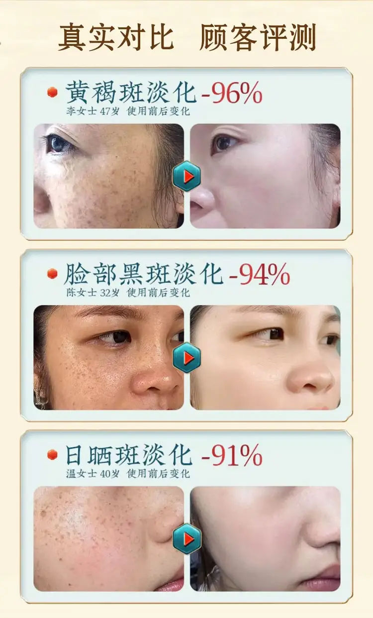 南京同仁堂面膜美白补水淡斑提亮肤色女祛斑面膜烟酰胺补水保湿25ml*20片/盒