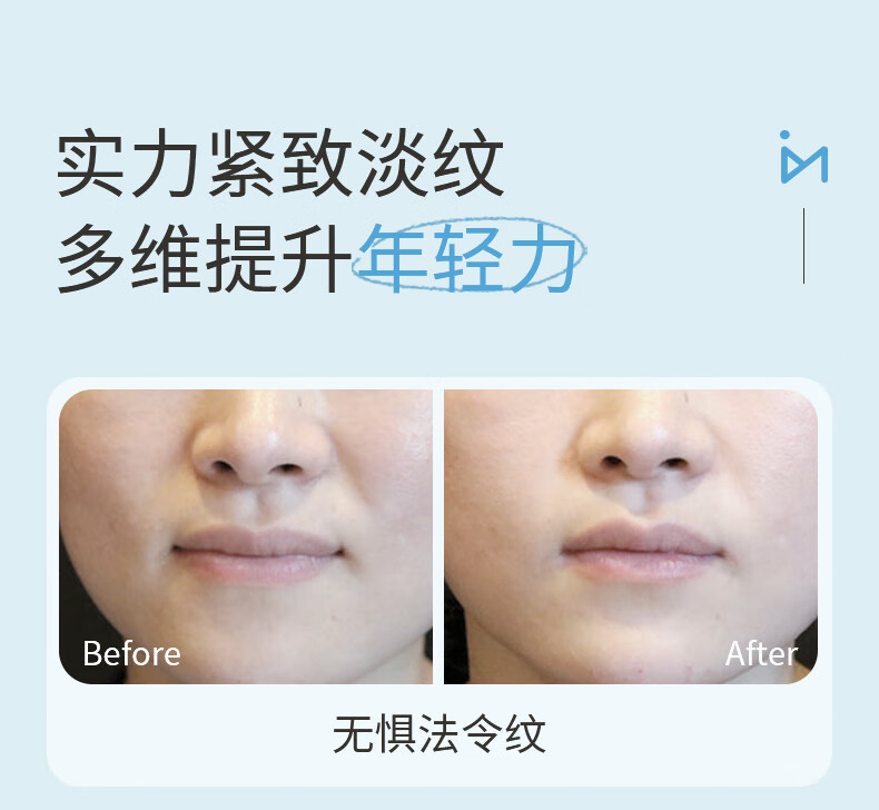 米云多肽紧致淡纹贴 法令纹贴 女嘴角细纹抬头纹颈部保湿面膜提拉免洗 单盒装