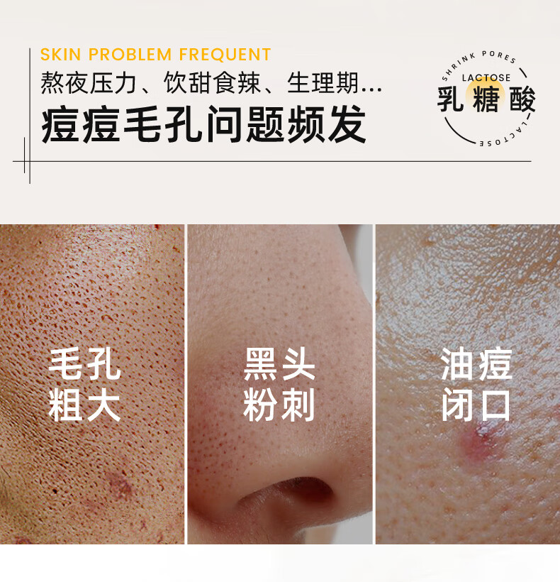 韩舜妆 （HORNCOS）乳糖酸毛孔净透水爽肤水补水保湿提亮面部湿敷精华原液男女