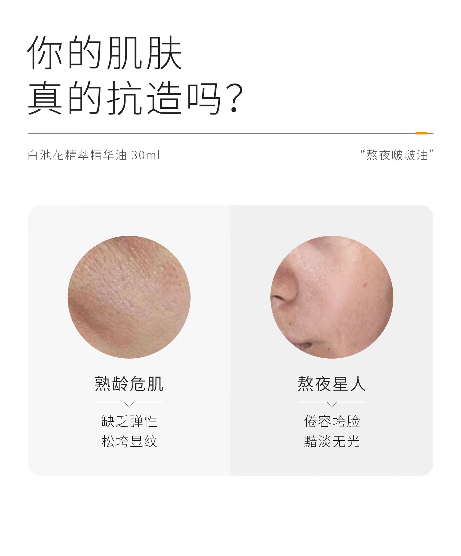 934白池花精粹精华油小弹簧熬夜啵啵油修护滋润紧致圣诞礼物男女适用 【大干皮】焕颜精华油30ml