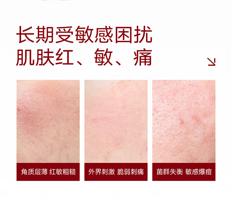 优理氏 酵母水乳护肤品套装 精华水110ml+精华乳100ml 敏感肌护肤品