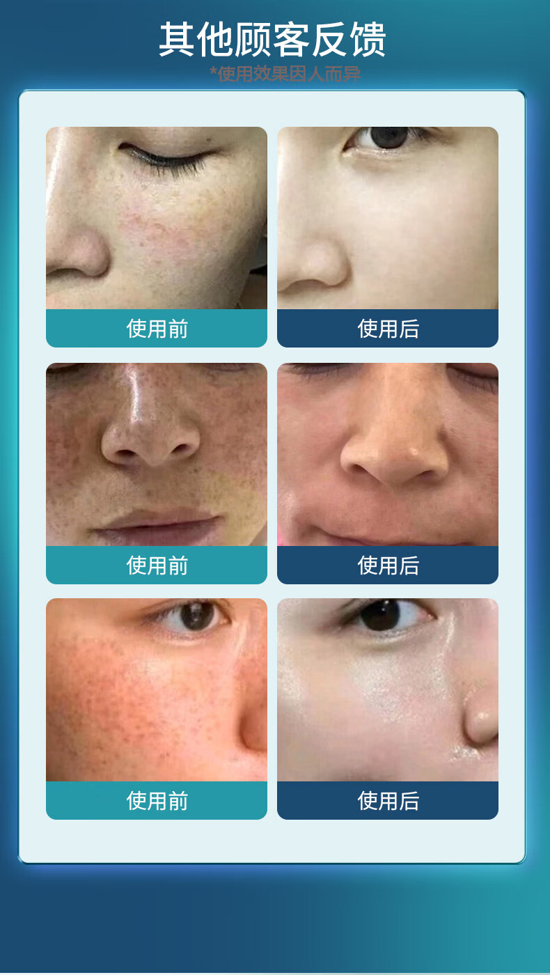 广药白云山美白祛斑霜男女士雀斑黄褐斑晒斑妊娠斑淡化黑色素溶斑霜50g