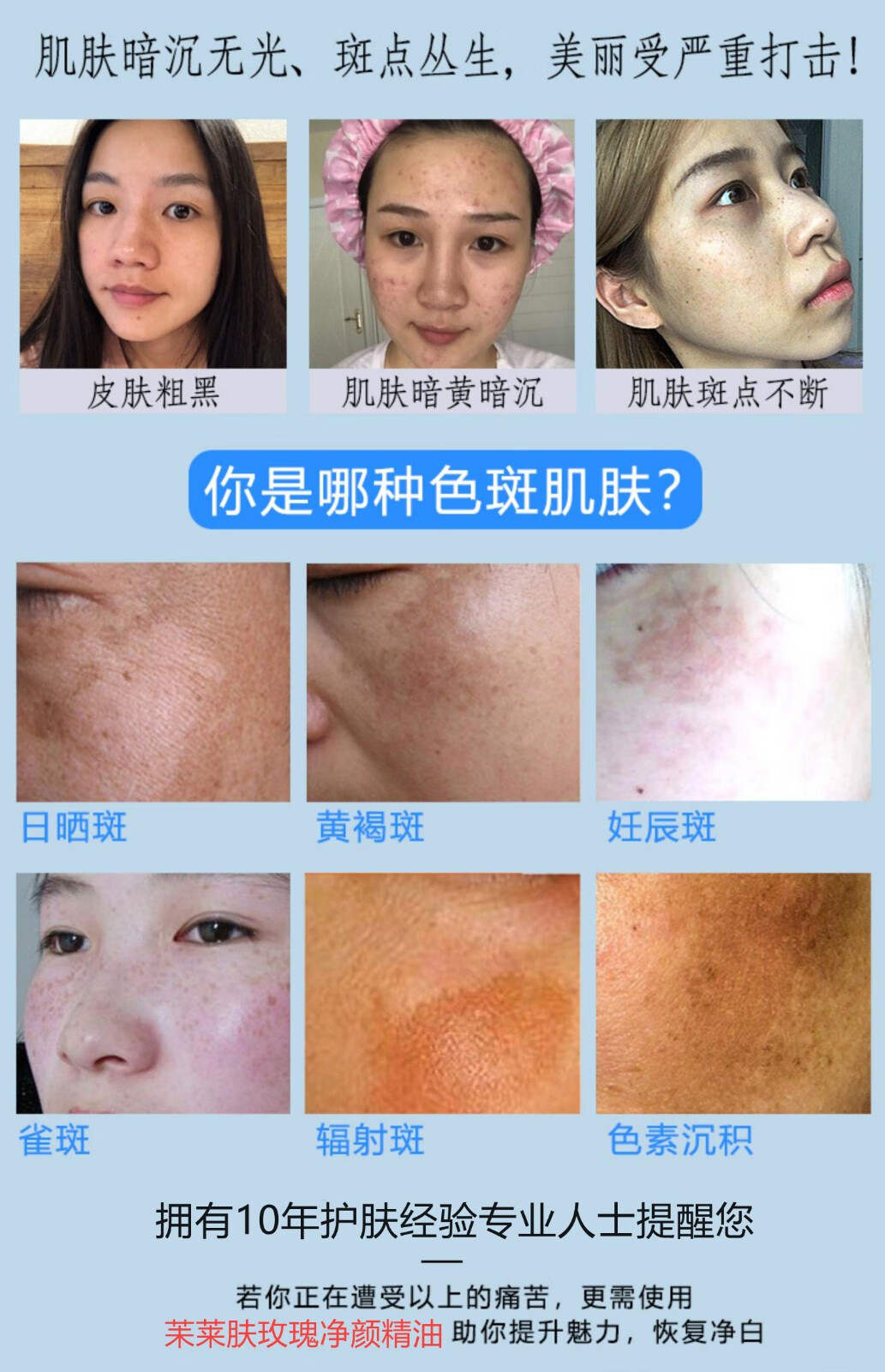 NHFOUYOU祛斑精华油点黑点玫瑰净颜精油补水美白提亮肤色溶斑精华美白淡斑 1瓶【体验装】