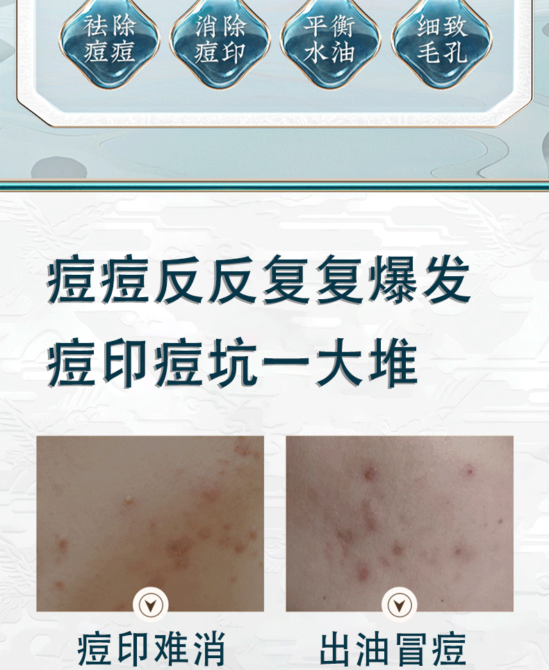 南京同仁堂祛痘膏痘疤痘坑痘痘肌呵护青春红肿痘闭口粉刺芦荟胶30g