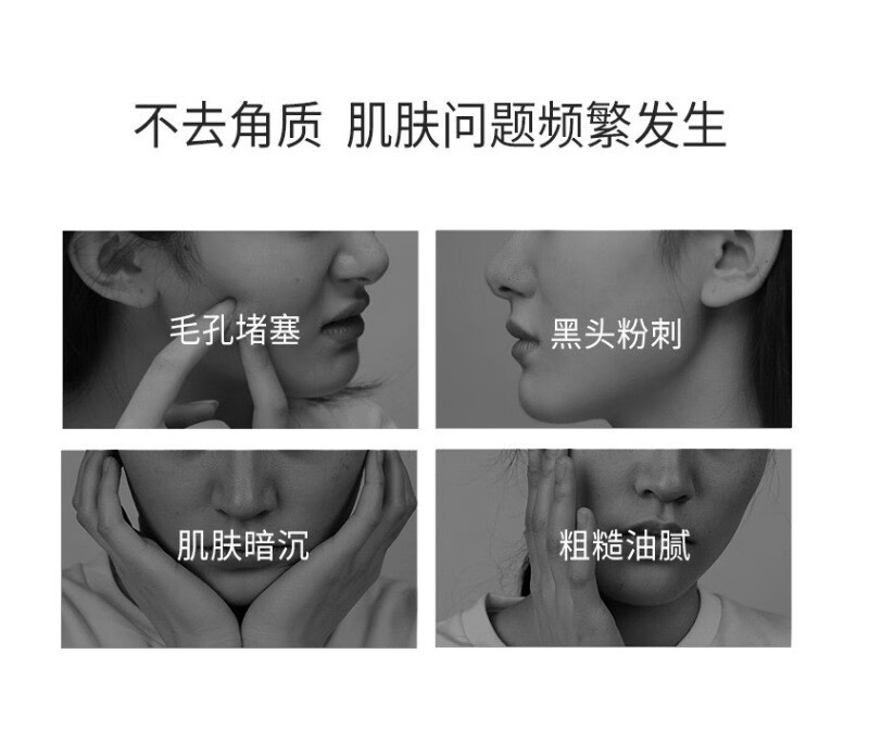窈窕雅品（YAOTIAO）芦荟去角质啫喱男女面部去死皮脸部身体清洁黑头洗面奶磨砂膏100g