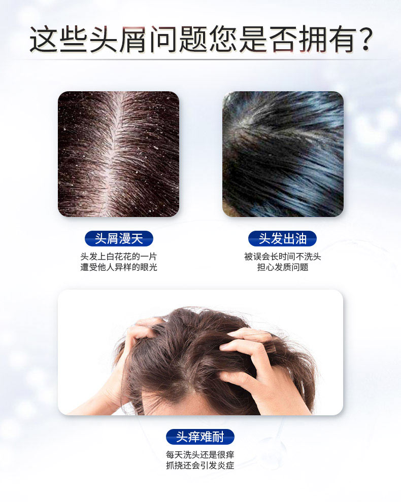 selsunblue1硫化硒去屑止痒洗发水男女日常滋养修复洗头膏200ml