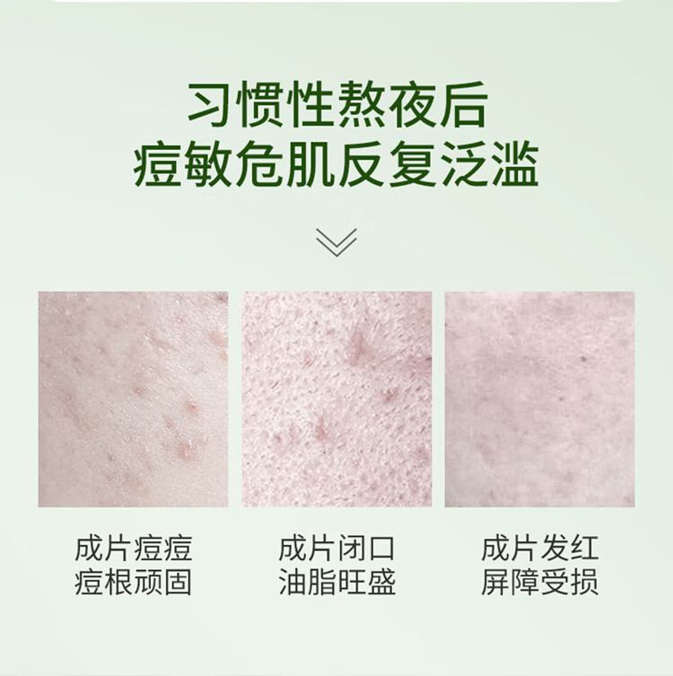 同仁堂（TRT）祛痘膏祛修复淡化痘印痘坑去痘痘和痘印膏痕疤20g