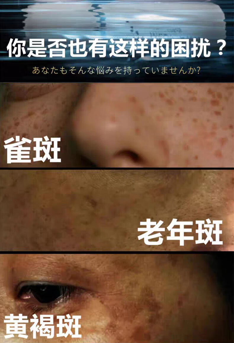 Jea·Love日本配方美白祛斑霜烟酰胺黄褐斑黑色素雀斑妊娠色淡化斑男女面霜