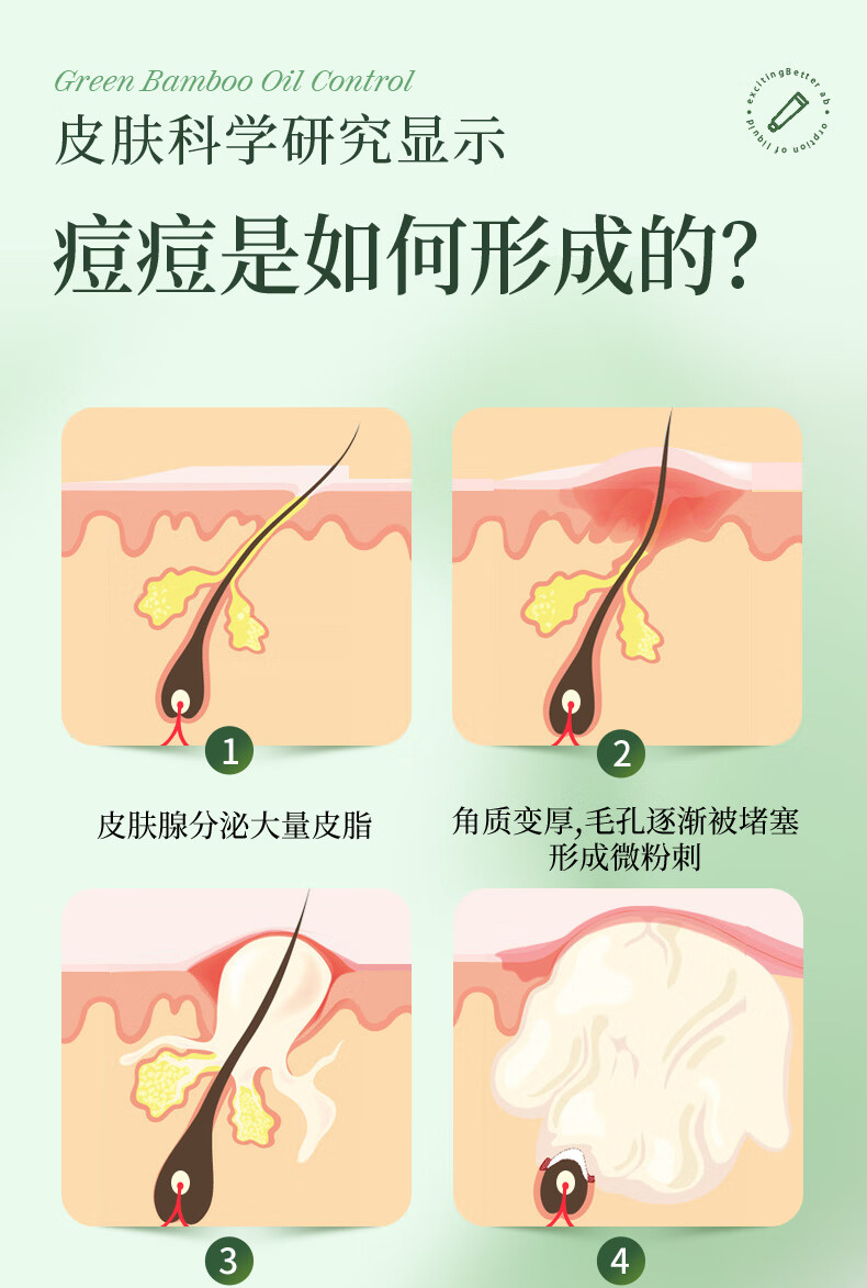 伊妆北京同仁堂 祛痘膏非祛痘印修复淡化痘印痘坑修复学生青春痘 祛痘膏 25g