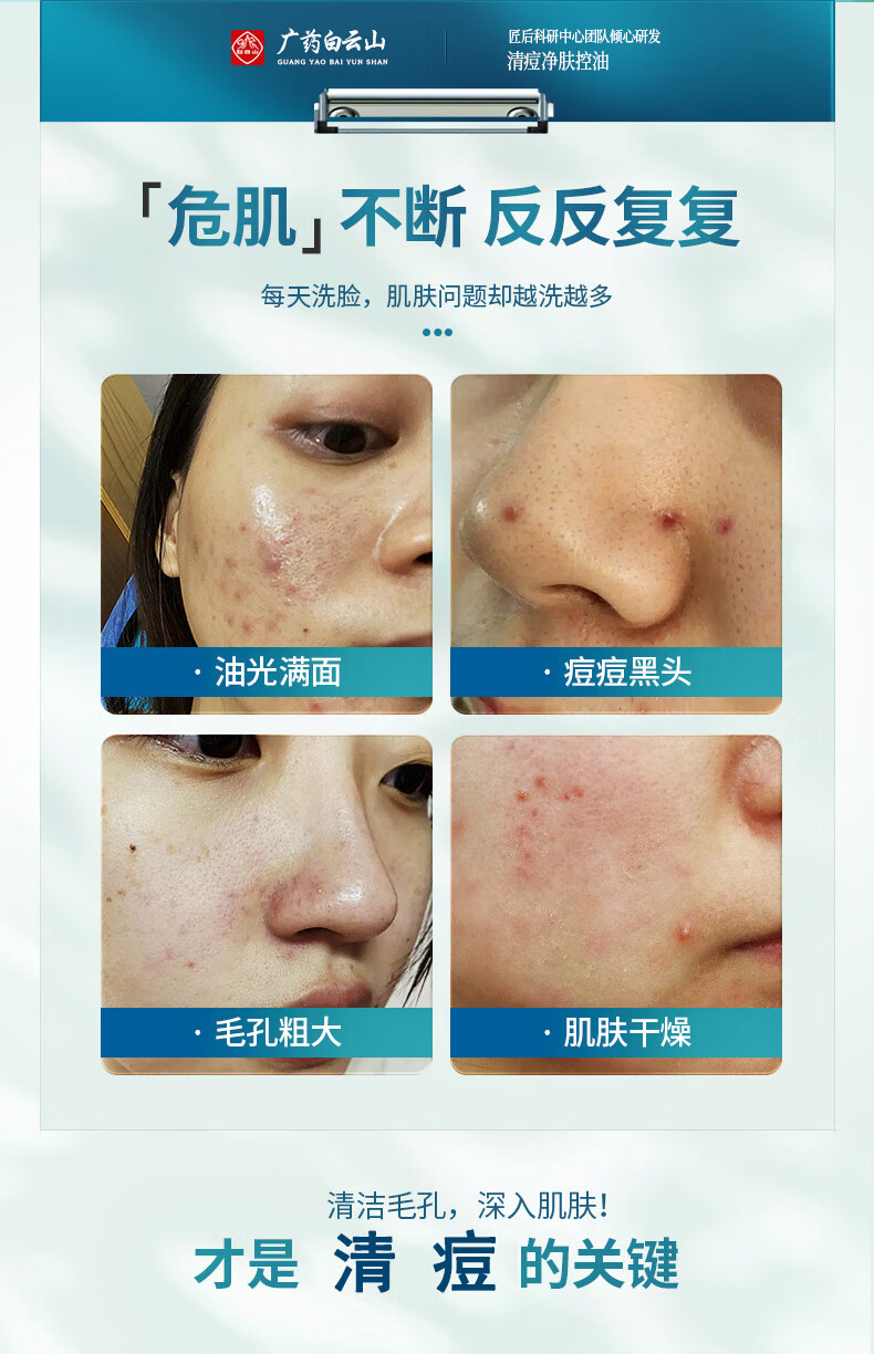 匠后苦参祛痘洗面奶除控油螨虫去黑头收缩毛孔粗大男女补水洁面乳200g