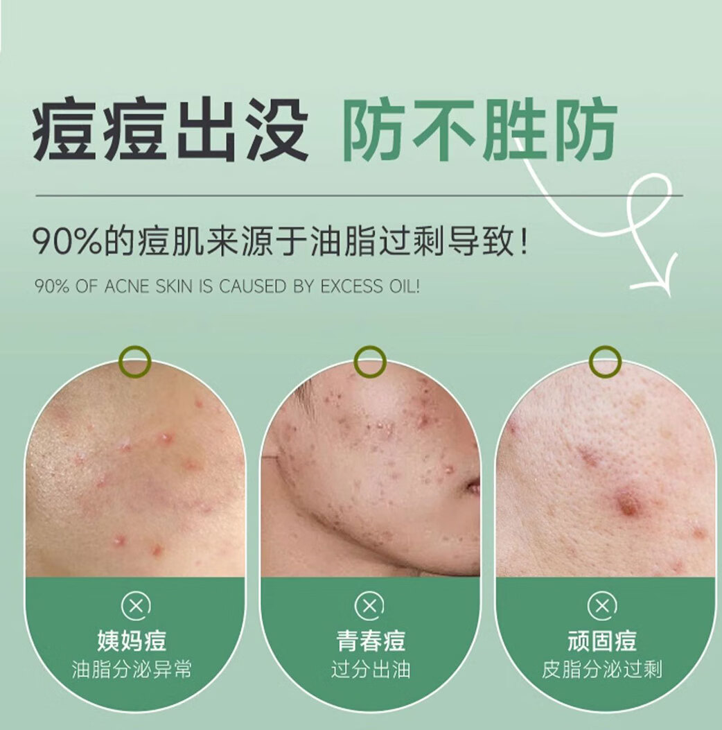同仁堂祛痘膏痘印修复淡化痘印痘坑修护痘肌亮肤青春痘男女可用20g