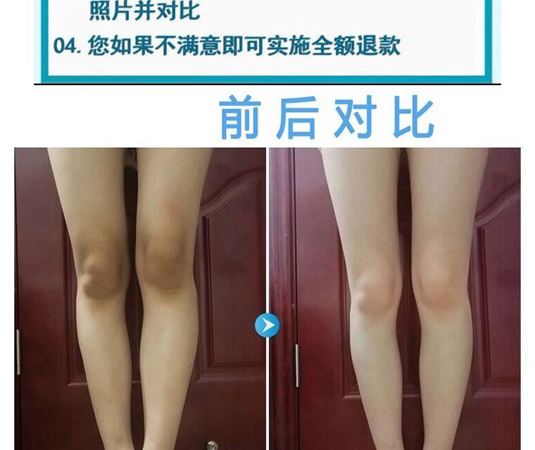 NHFOUYOU【不黑不买】美白全身关节膝盖手指手肘脖子美白祛斑霜淡化色素 1盒【建议按疗程】