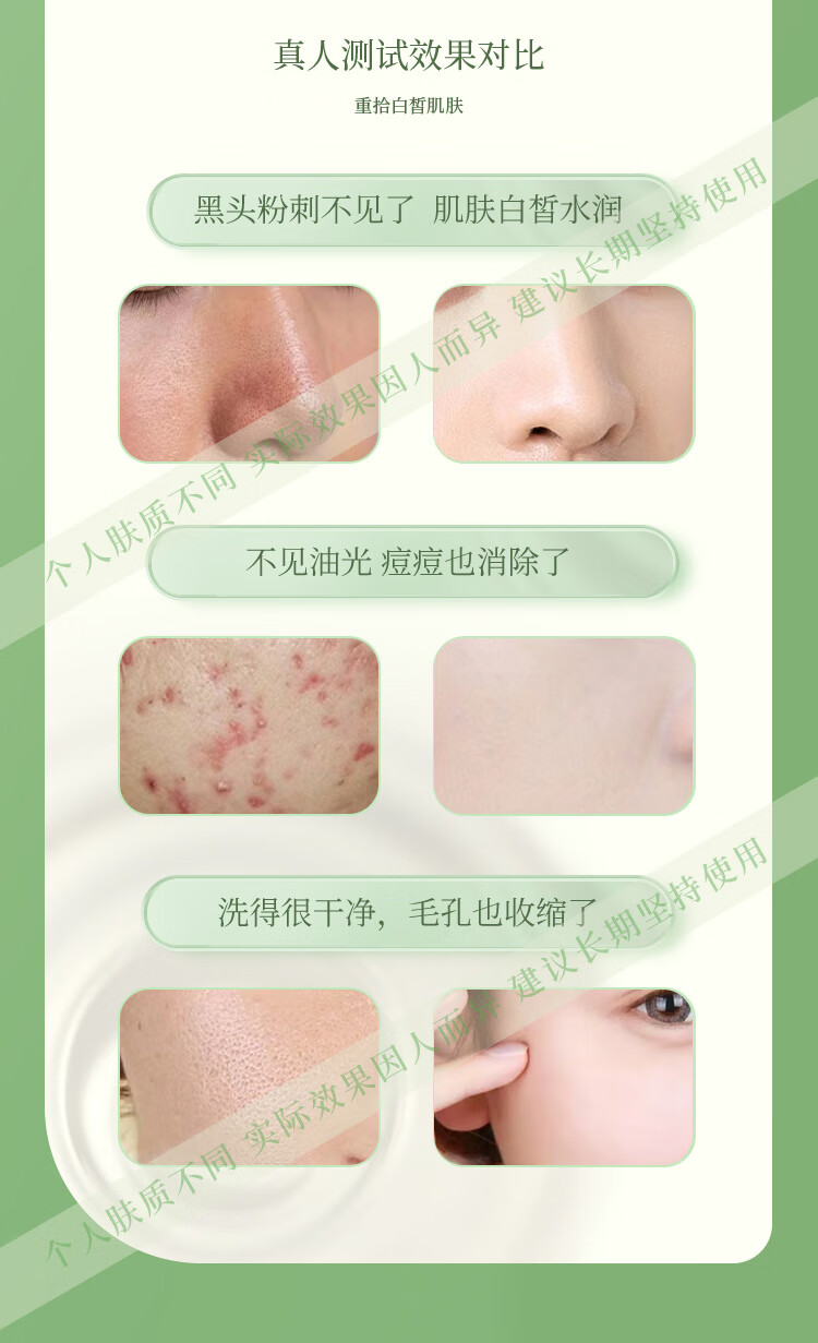 初霜【净痘控油除螨率＞99%】氨基酸深层清洁面乳去角质粉刺洗面奶女 银色装【温和配方.敏感肌适用】 每瓶180g ( 控油除螨率达99% )