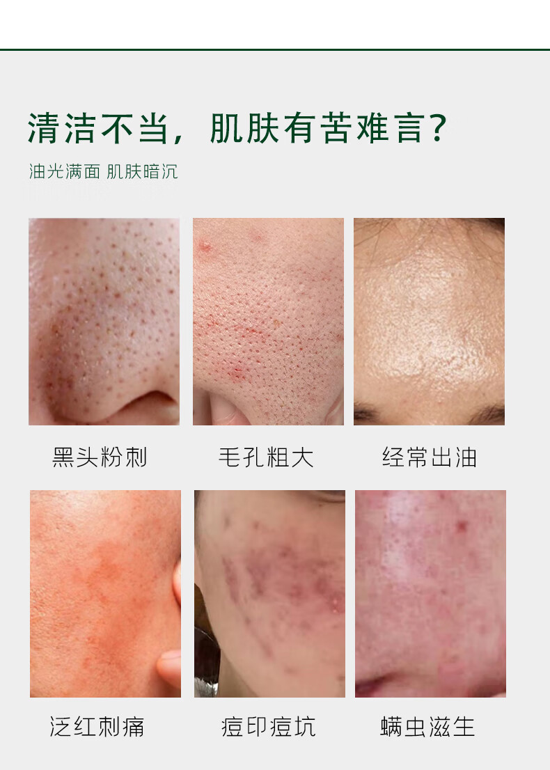 CMFM水杨酸氨基酸洗面奶抗痘黑头粉刺角质深层清洁收缩毛孔控油洁面乳