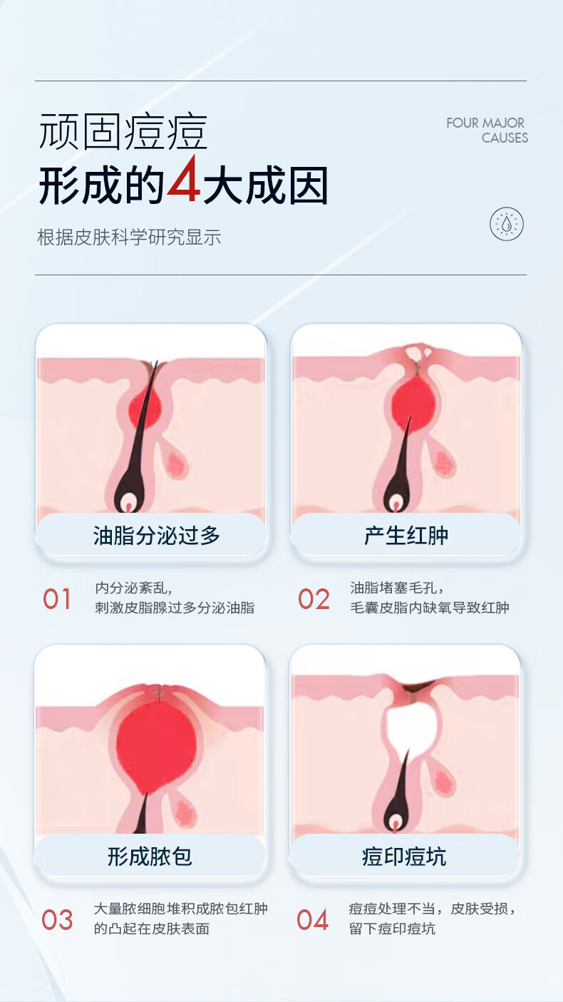国药精养祛痘膏去痘疤淡化痘印痘坑修复痘肌亮肤青春痘40g
