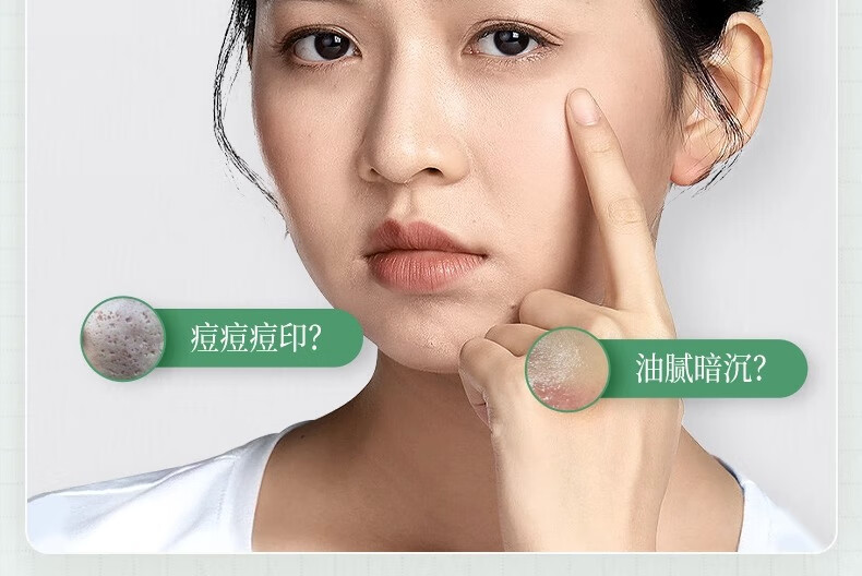 ORGINESE欧橘植萃舒缓祛痘精华液修护痘坑呵护肌肤男女通用30ml礼物女