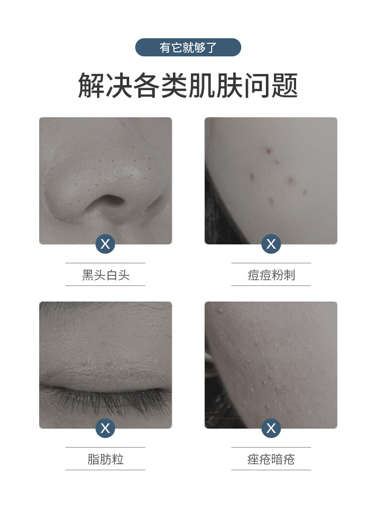 优家 多功能粉刺针暗疮针4件套 黑头针痘痘针挤痘工具