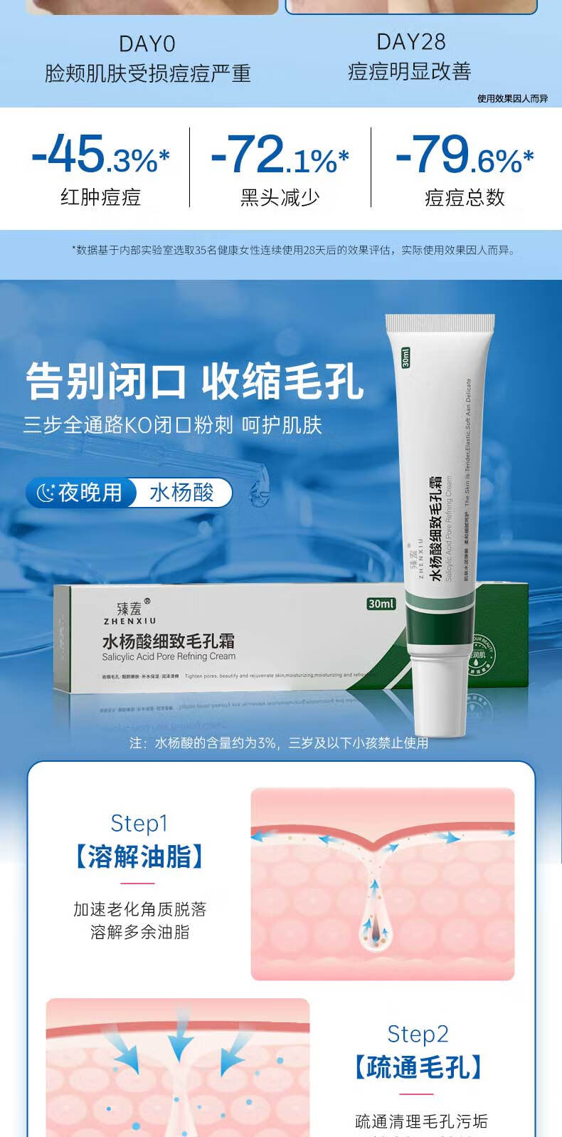 珂卡薇壬二酸15%凝胶水杨酸细致毛孔霜修颜凝露淡痘印黑头闭口粉刺30ml