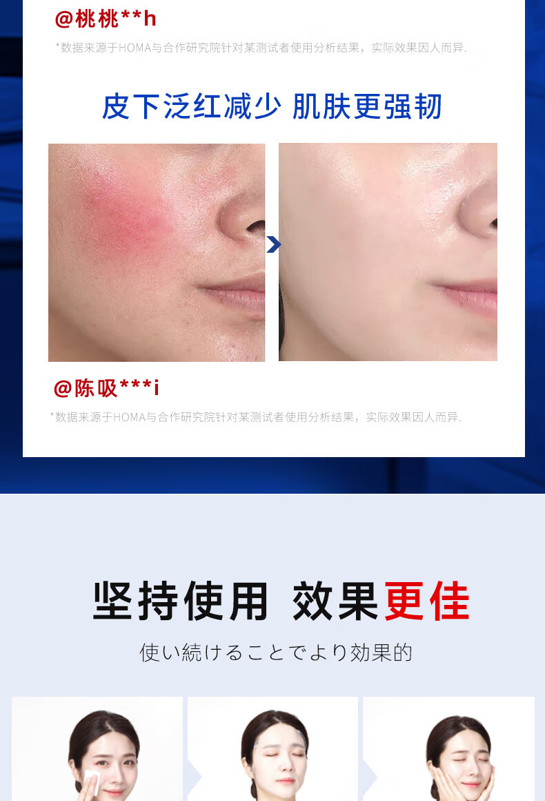 彤生泉面膜修复淡化祛痘印美白补水保湿收缩毛孔熬夜舒缓修护女男士专用 舒缓修复面膜1盒（10片）