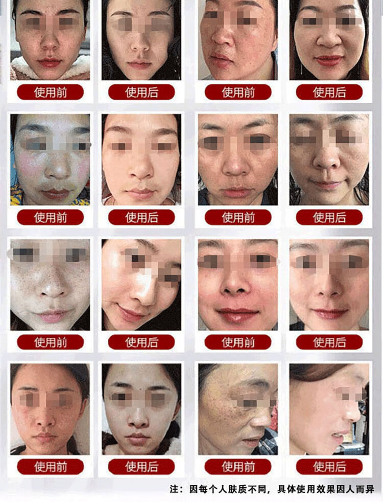 南京同仁堂美白洗面奶祛斑女士净痘黄褐斑雀斑提亮肤色深层清洁控油洁面乳120g